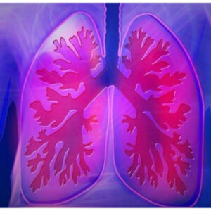 Lung Cancer Symptoms: फेफड़ों के कैंसर के लक्षण, कारण और इलाज