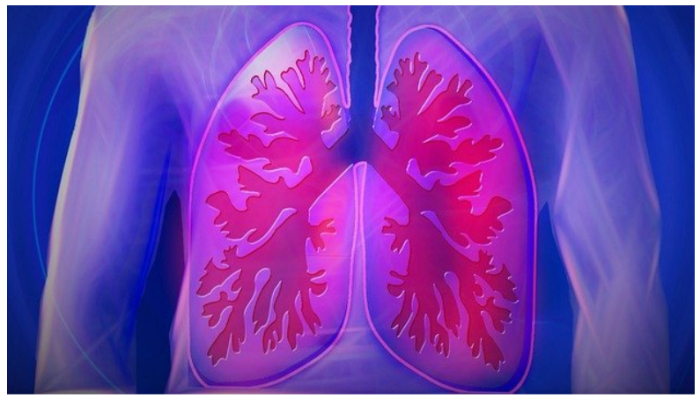 Lung Cancer Symptoms: फेफड़ों के कैंसर के लक्षण, कारण और इलाज