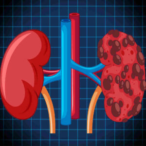 Kidney Failure: किडनी फेल होने से बचना है? इन 5 आदतों को तुरंत बदलें (Image Credit: Freepik)