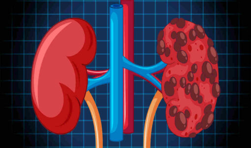 Kidney Failure: किडनी फेल होने से बचना है? इन 5 आदतों को तुरंत बदलें (Image Credit: Freepik)